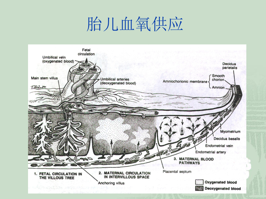 医学胎儿窘迫Fetal-Distress课件.ppt_第3页