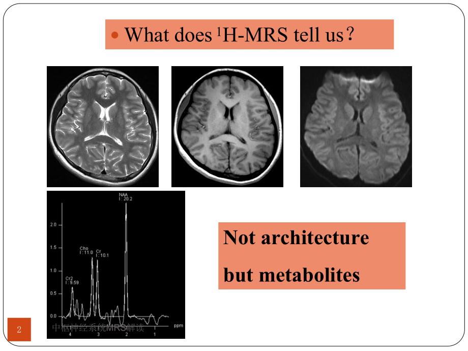 中枢神经系统MRS解读培训课件.ppt_第2页
