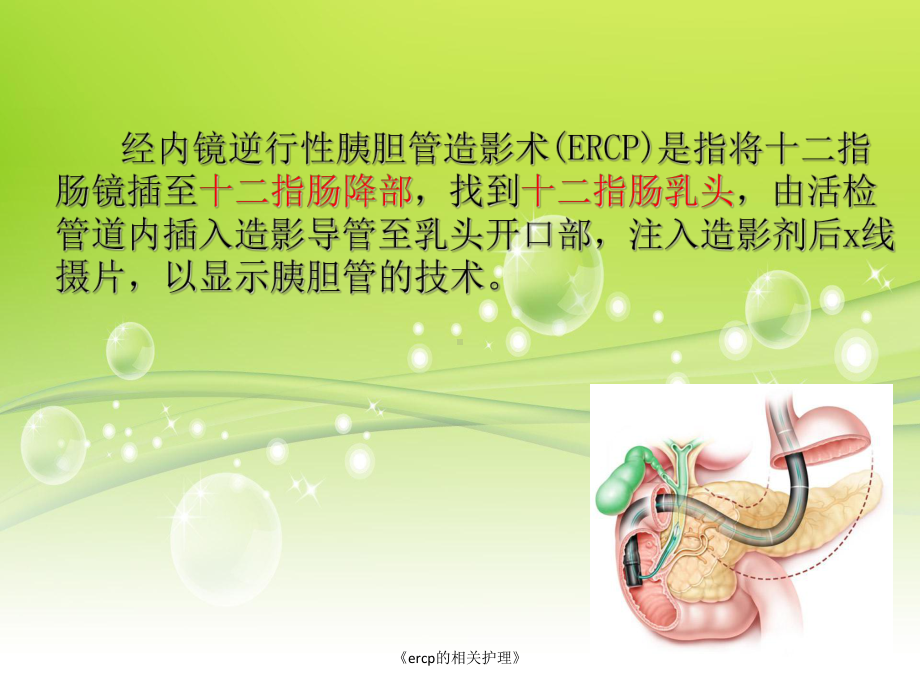 《ercp的相关护理》课件.ppt_第2页