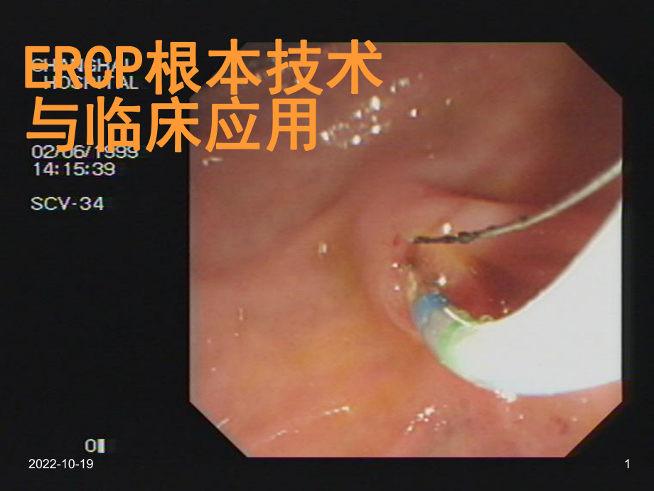 ercp基本技术与临床应用课件.ppt_第1页