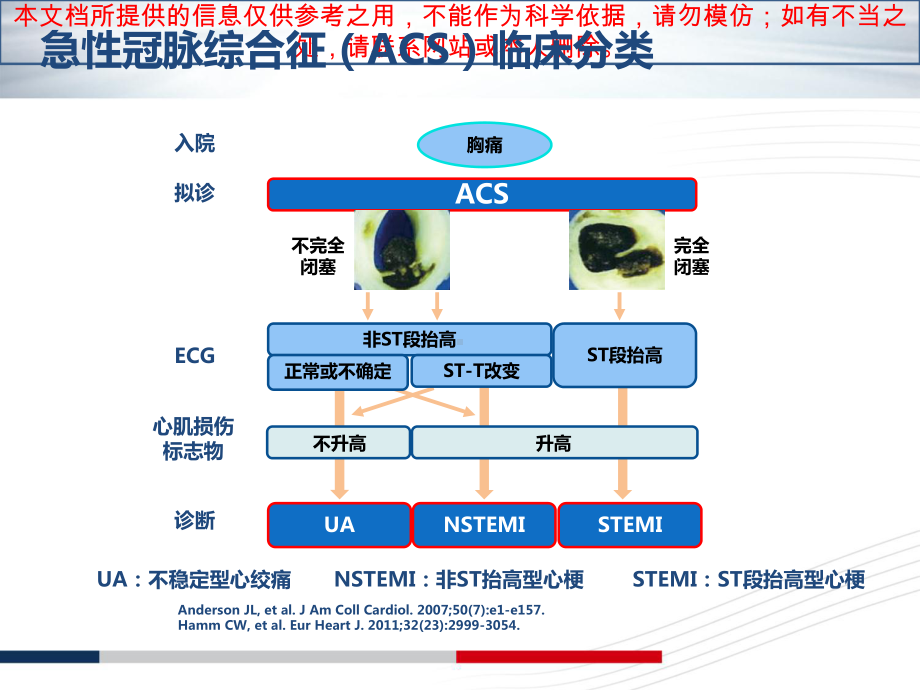 NSTEACS诊疗标准和治疗原则解读培训课件.ppt_第2页