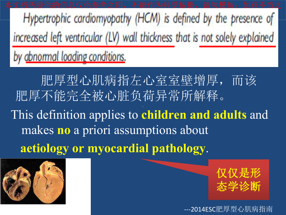 ESC肥厚型心肌病培训课件.ppt_第3页