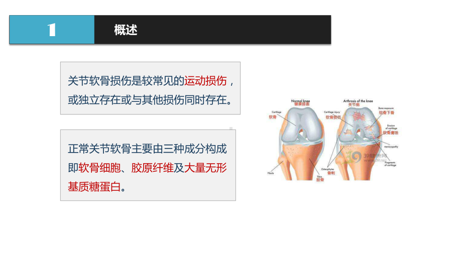 膝关节软骨损伤的康复课件.pptx_第3页