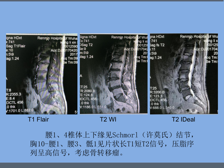 MRI诊断入门病例-课件.ppt_第2页