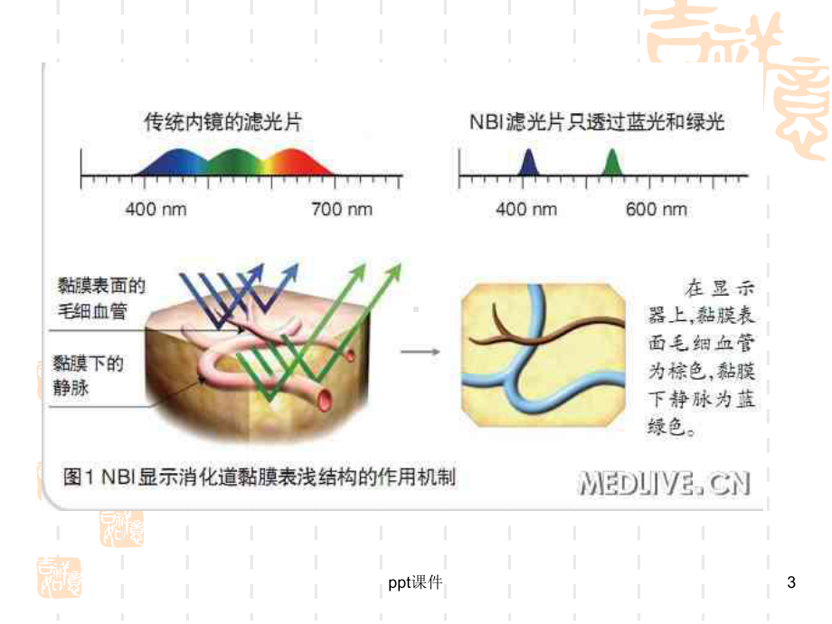 NBI内镜在消化道早癌诊断中应用-课件.ppt_第3页