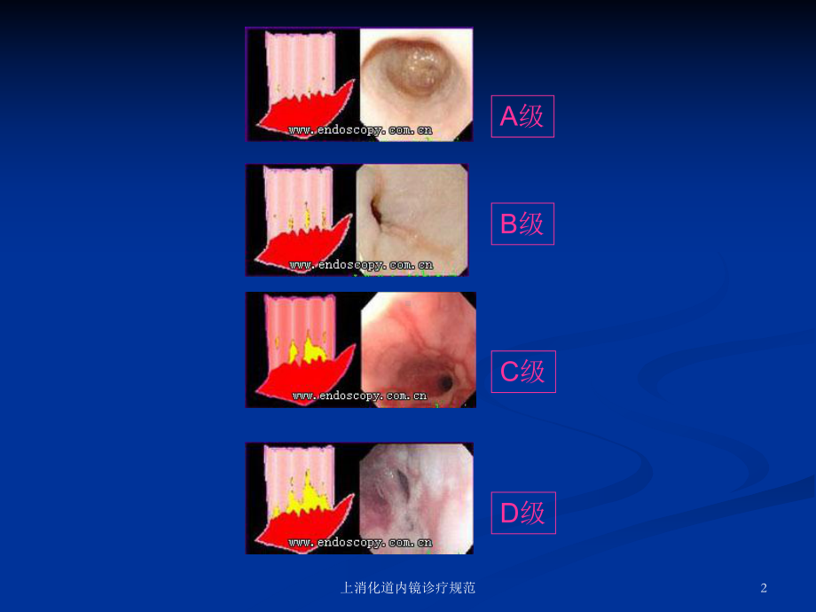 上消化道内镜诊疗规范培训课件.ppt_第2页