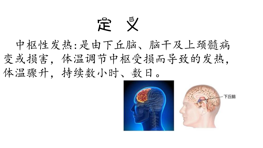 中枢性高热的护理课件.pptx_第3页