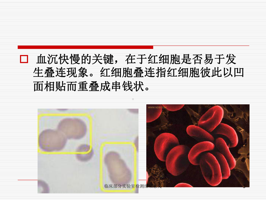 临床部分实验室检测结果意义培训课件.ppt_第3页