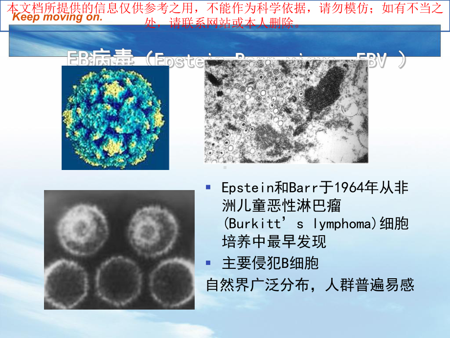 EB病毒感染和传染性单核细胞增多症培训课件.ppt_第2页