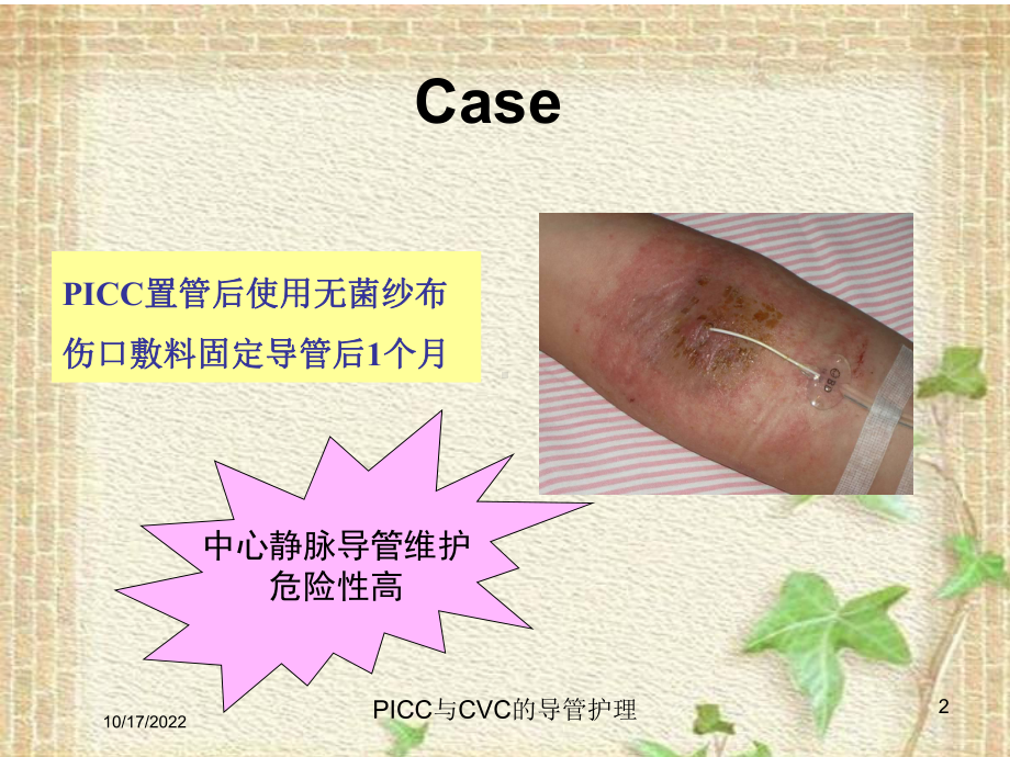 PICC与CVC的导管护理培训课件.ppt_第2页