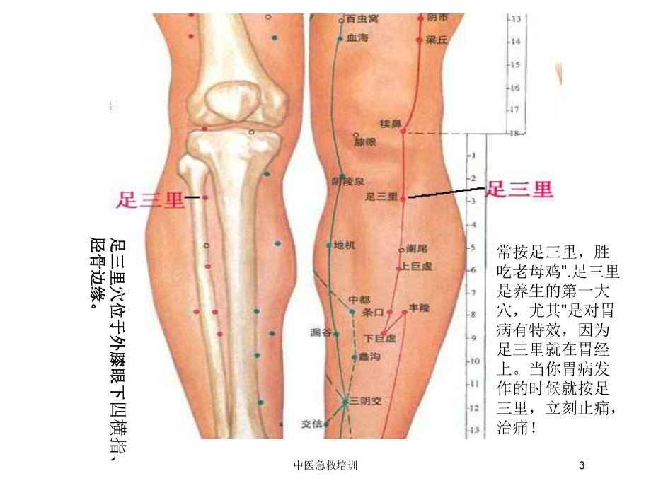 中医急救培训培训课件.ppt_第3页