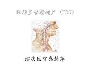 经颅多普勒(TCD)讲解完整版本课件.ppt