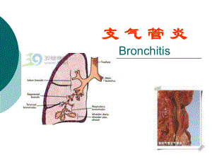 中医支气管炎课件.pptx