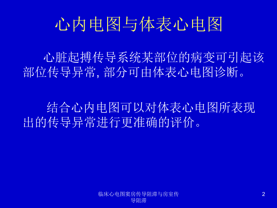 临床心电图窦房传导阻滞与房室传导阻滞课件.ppt_第2页