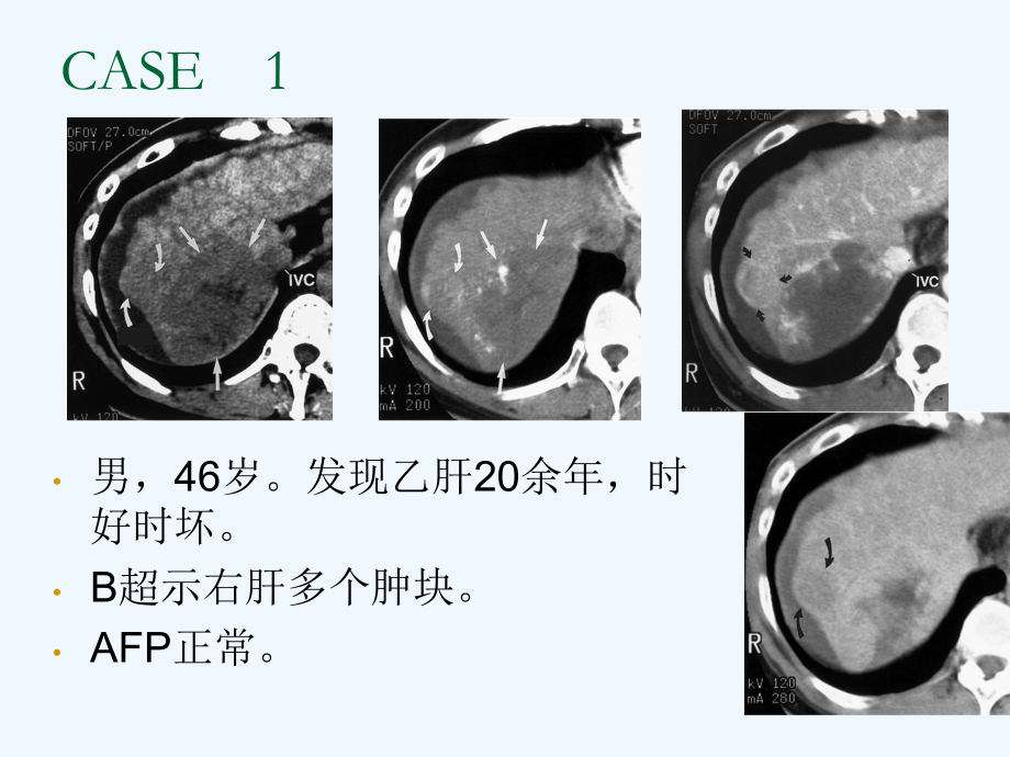 临床思维和技能训练腹部病变影像鉴别诊断课件.ppt_第2页