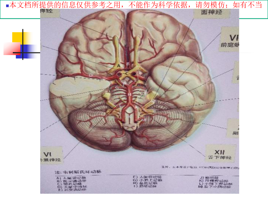 TIA患者的医疗护理培训课件.ppt_第3页