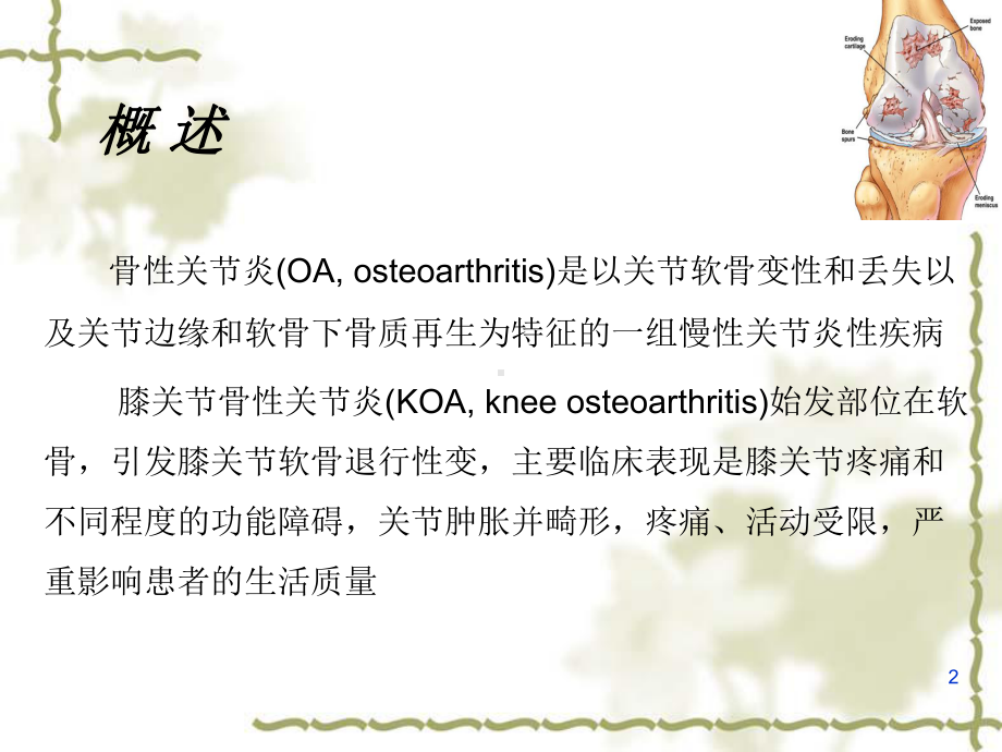 KOA治疗新观点课件.pptx_第2页