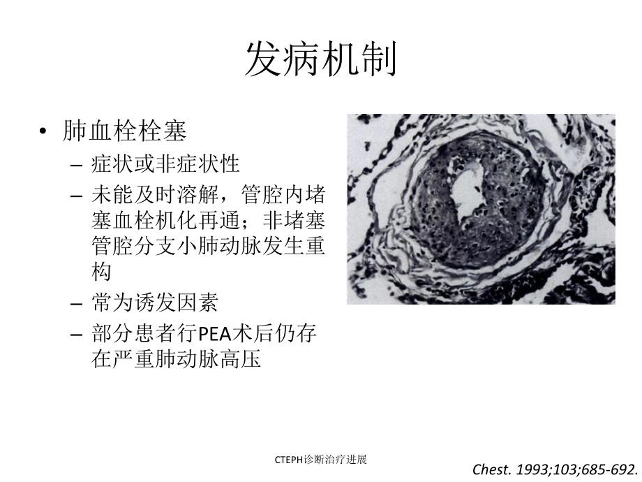 CTEPH诊断治疗进展课件.ppt_第3页