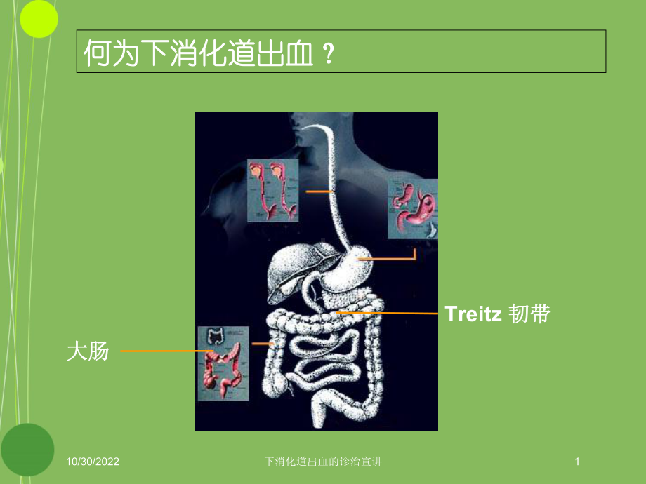 下消化道出血的诊治宣讲培训课件.ppt_第1页