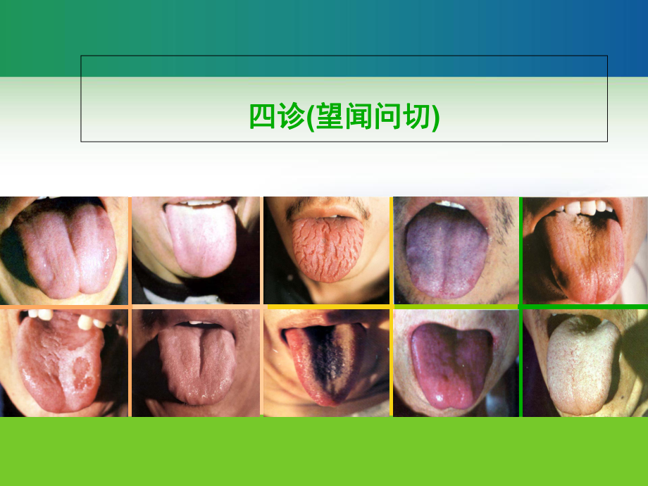 中医诊断学四诊望闻问切-课件.ppt_第2页