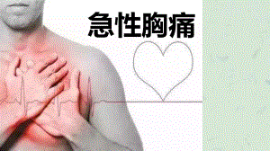 《急性胸痛》课件.pptx