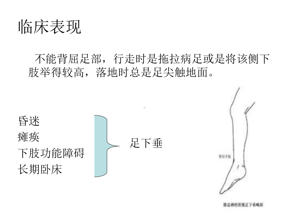 足下垂的预防及护理课件.ppt_第3页