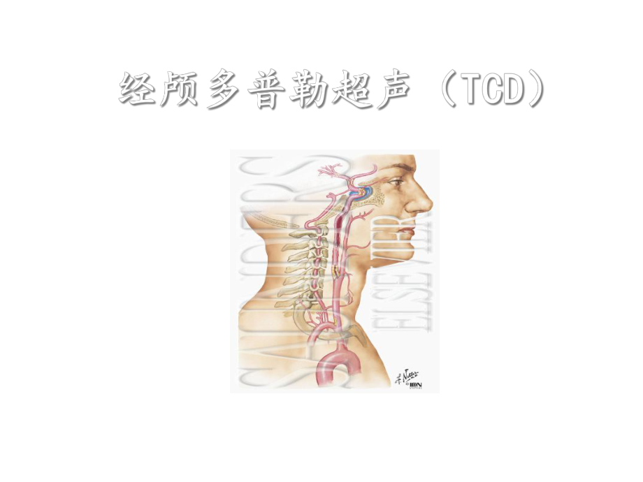 经颅多普勒(TCD)讲解课件.ppt_第1页