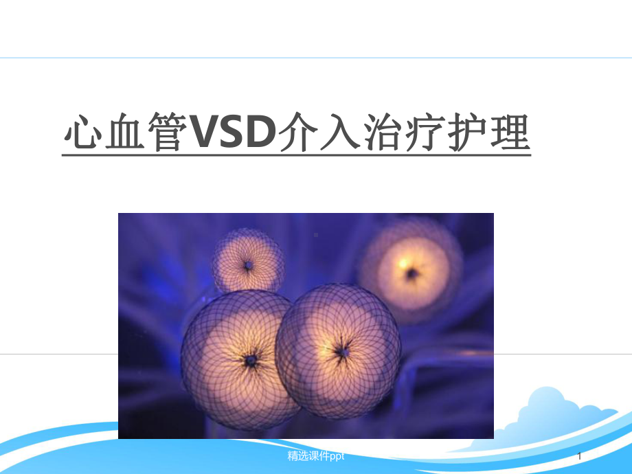 VSD介入术前术后护理课件.ppt_第1页