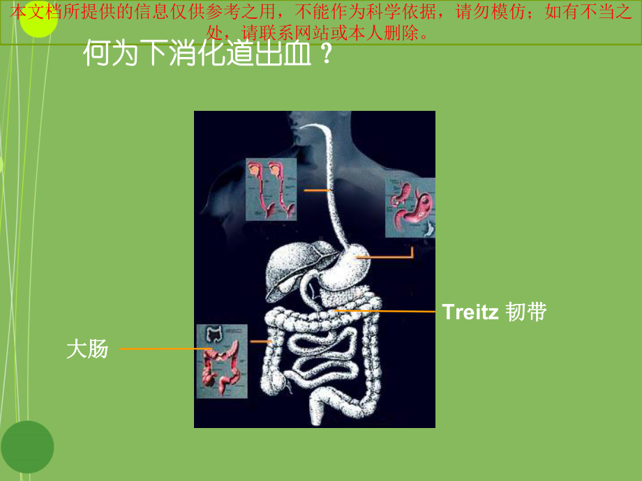 下消化道出血的诊治培训课件.ppt_第1页