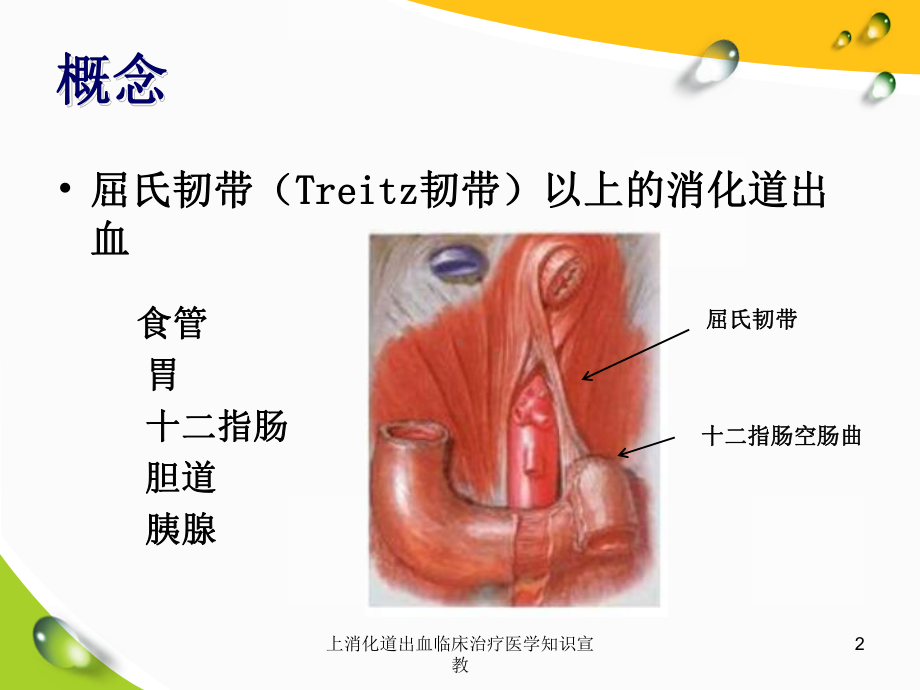 上消化道出血临床治疗医学知识宣教培训课件.ppt_第2页