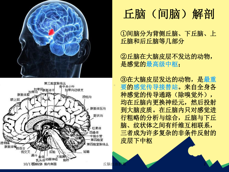 丘脑出血护理培训课件.ppt_第2页