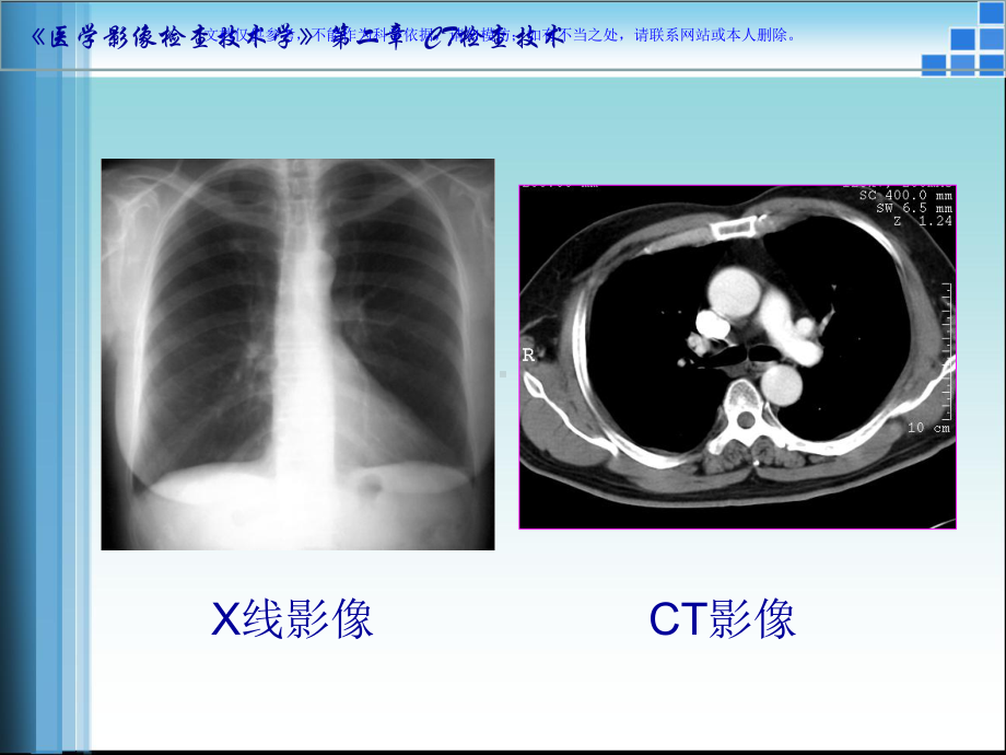 CT检查技术方法课件.ppt_第1页