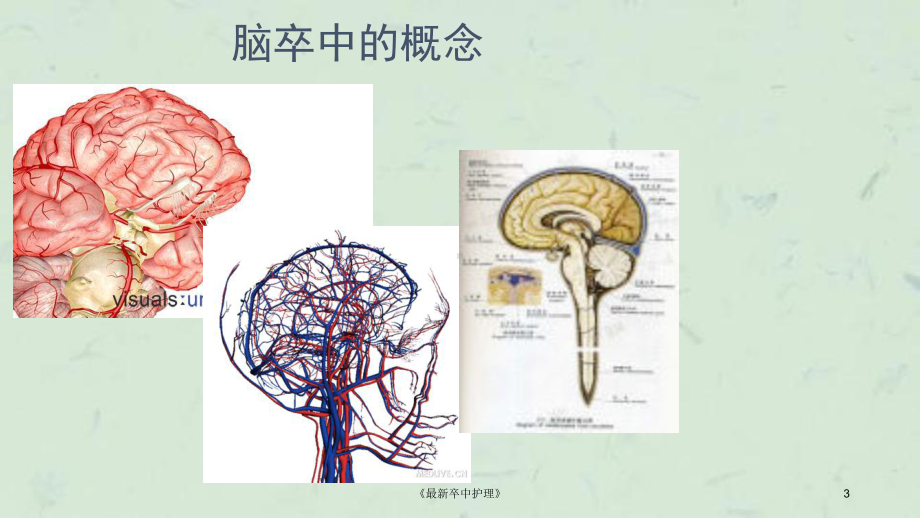 《卒中护理》课件.ppt_第3页