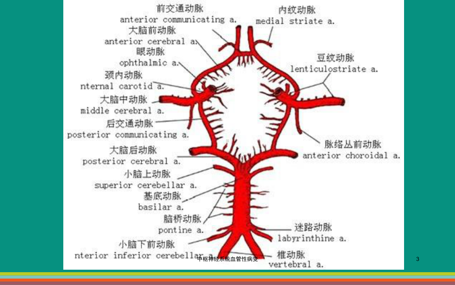 中枢神经系统血管性病变课件.ppt_第3页