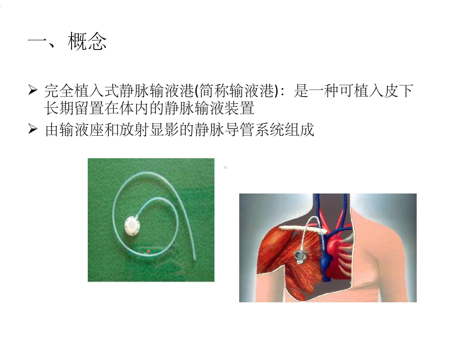 输液港的护理课件.ppt_第3页