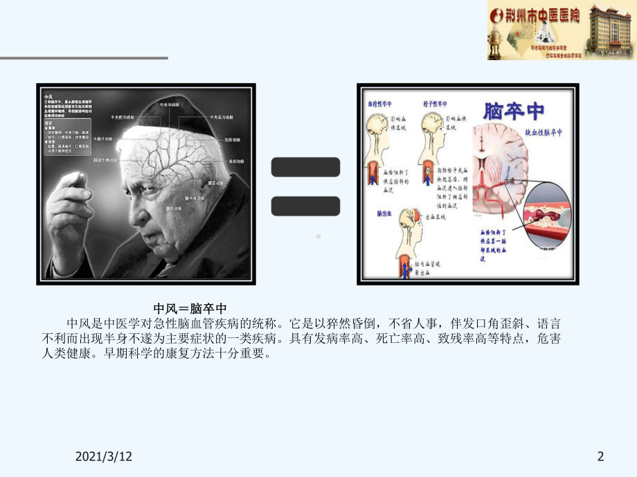 中风康复宜早针灸课件.ppt_第2页