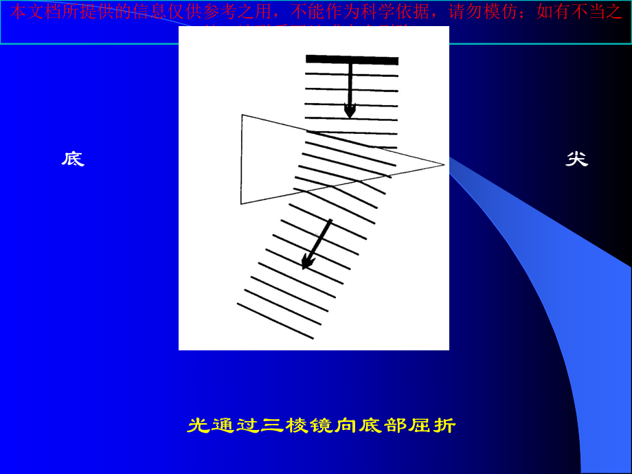 三棱镜在眼科的应用培训课件.ppt_第3页