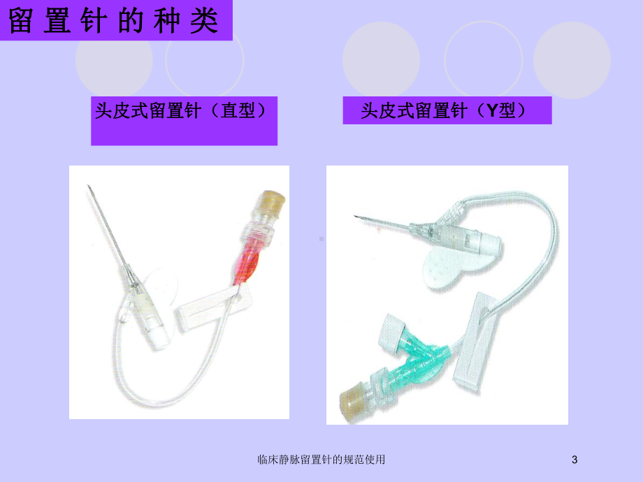 临床静脉留置针的规范使用培训课件.ppt_第3页