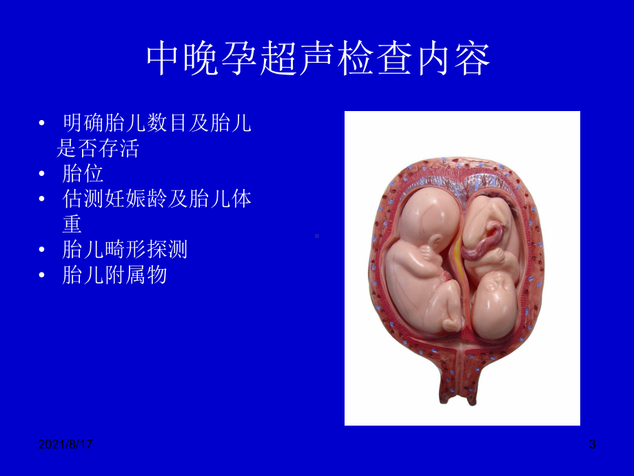 《产科超声》课件.ppt_第3页