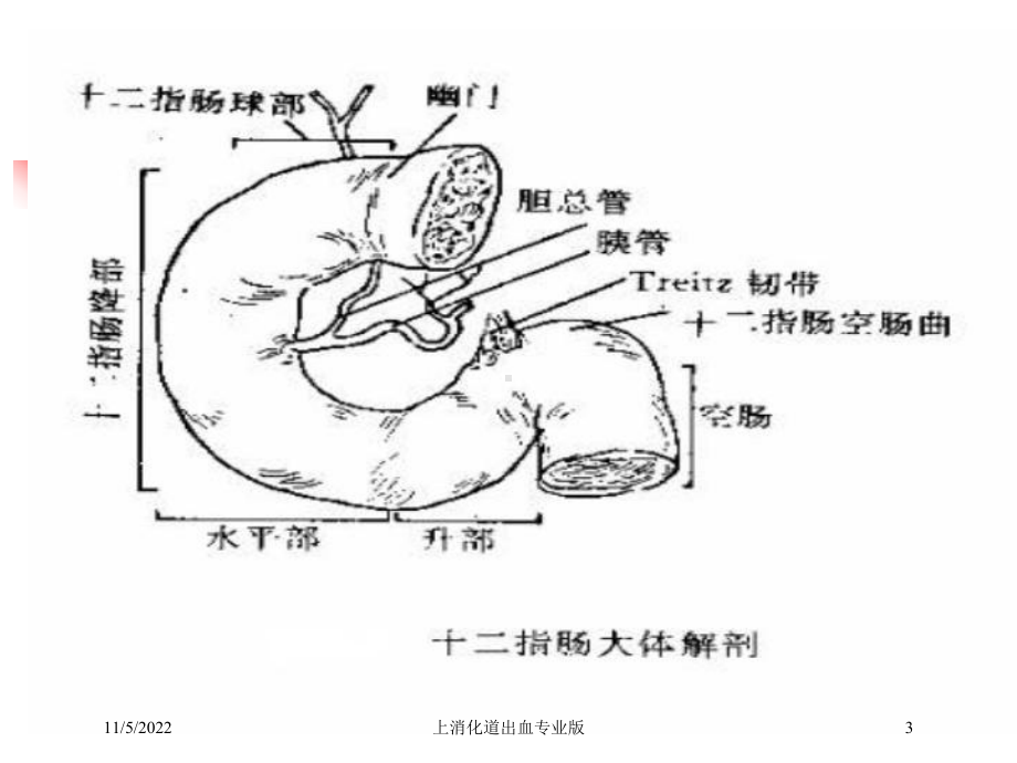 上消化道出血专业版培训课件.ppt_第3页