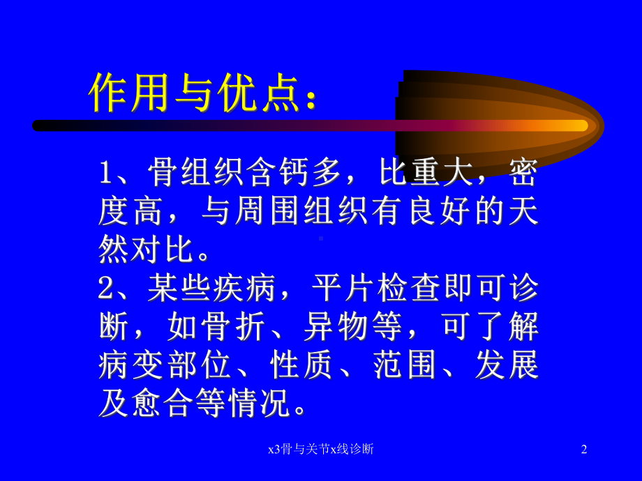 x3骨与关节x线诊断课件.ppt_第2页