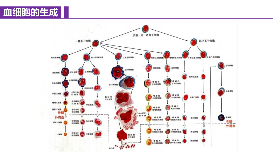 白血病病人的护理课件.pptx_第3页