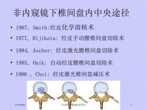 不同脊柱微创技术简介培训课件.ppt