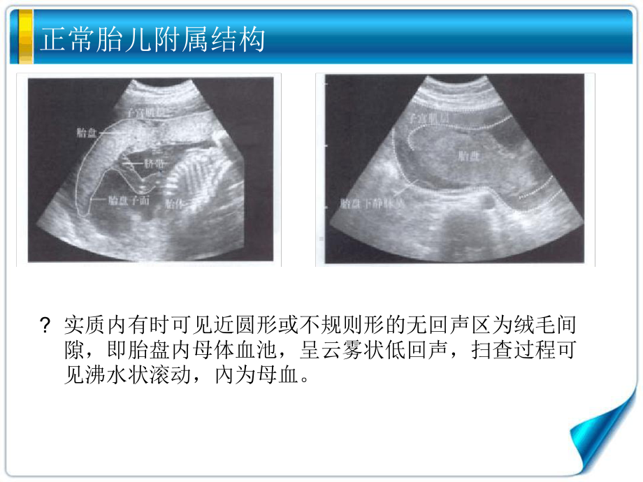 胎儿附属结构课件.ppt_第3页