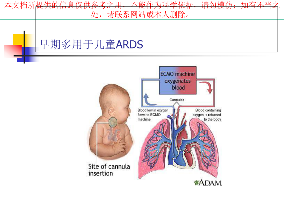 ECMO支持下心脏急危重症救治培训课件.ppt_第3页