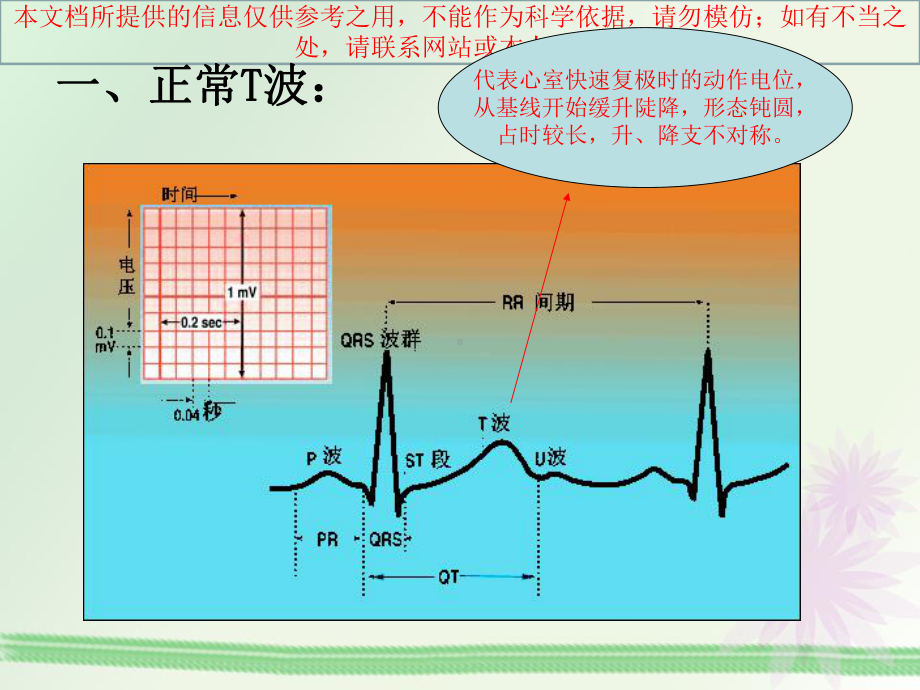 T波改变的临床意义培训课件.ppt_第1页