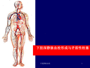 下肢静脉血栓课件.ppt