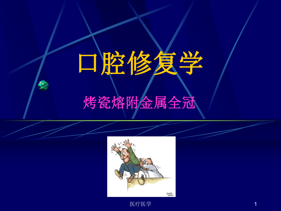 PMF-口腔修复学-金属烤瓷冠(行业运用)课件.ppt_第1页