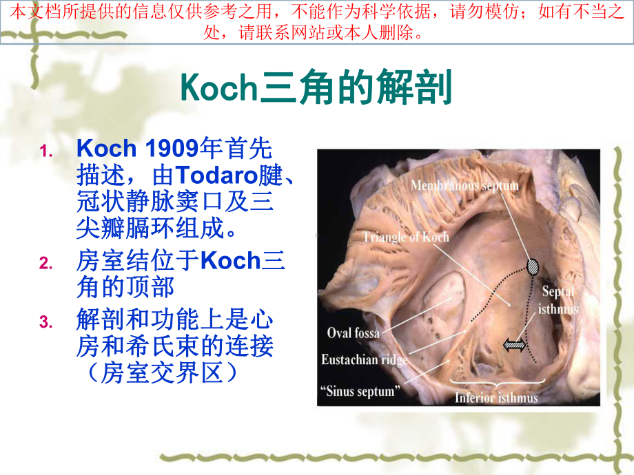 Koch三角解剖和临床医疗培训课件.ppt_第2页