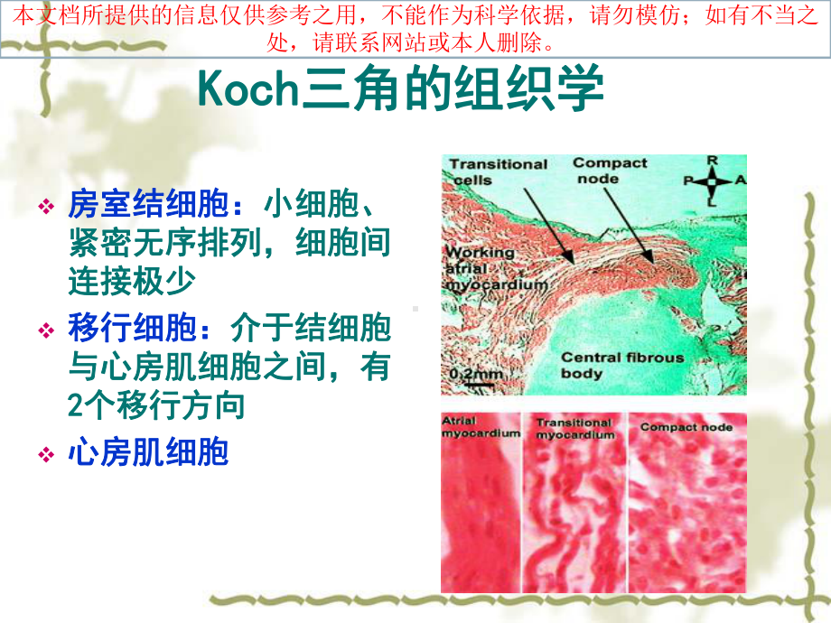 Koch三角解剖和临床医疗培训课件.ppt_第3页